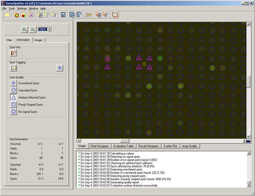 Artefact detection